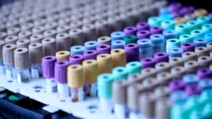 Plusieurs tubes de prélèvement sanguin prêts pour des analyses médicales en laboratoire.